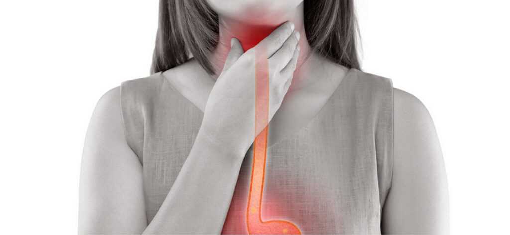 achalasia, achalasia causes, achalasia symptoms